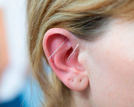 Aurikuloterapie 2: ušní akupunktura pro pokročilé